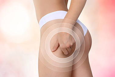 Schöner. Straffer. Sinnlicher. Sichtbar!