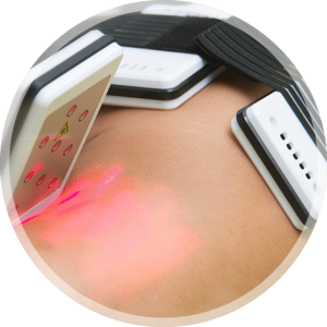 SlimStyler - Lasertechnologie zur Gewichtsreduktion